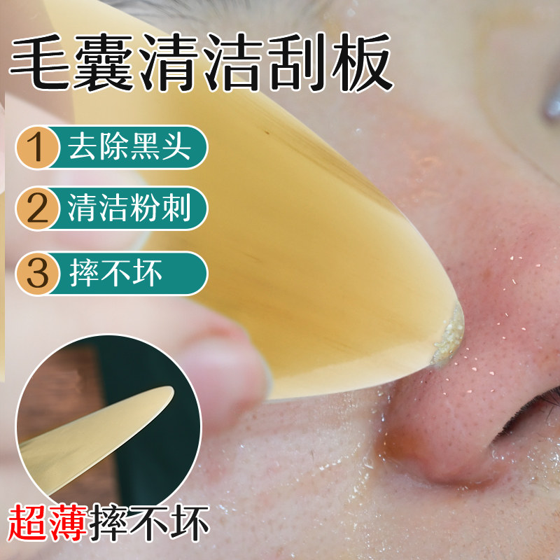 超薄款牛角毛囊清洁术刮板去黑头粉刺面部净化毛孔美容院专用刮痧