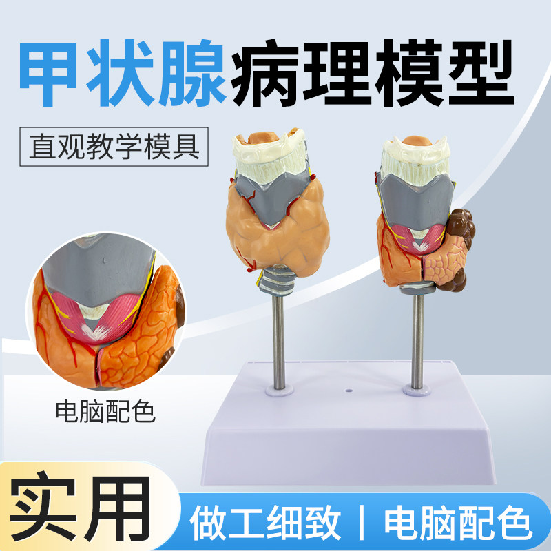 甲状腺病理模型 甲状腺 甲亢甲低 甲状腺肿留模型 甲状腺病理模型