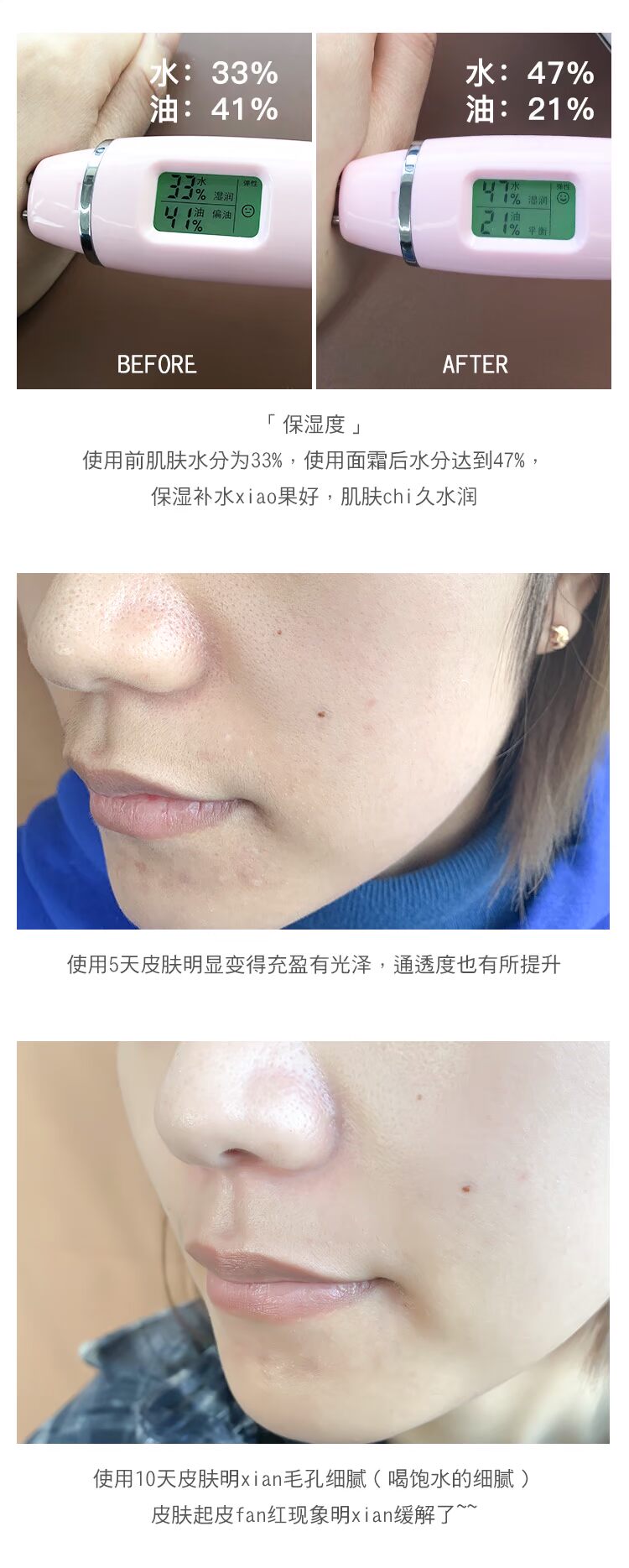 Zhang Mofan / kem dưỡng da Nhật Bản tunemakers ceramide gốc kem dưỡng ẩm sửa chữa giữ ẩm - Kem dưỡng da dưỡng ẩm vaseline