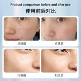 Немецкая лазерная ручка для удаления плоских бородавок, артефактная ионная точка, удаление родинок, веснушки, бородавки на шее, маленький инструмент для удаления плоти bl