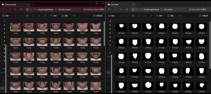 Unet++ Tongue Image Segmentation Data Set + Code + Model + System Interface