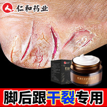 Jen and Rhagina Cracked Frozen Sore Cream Antifreeze Cream Antifreeze Anti-Crack Protective Hand Cream Official Flagship Store