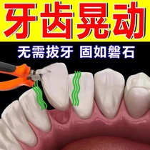 (Tooth Slit Leniency) Tooth Loose Repair Solid Tooth Gingival Swelling Pain Atrophied Dental Plaque Nursing Tongrentang Toothpaste