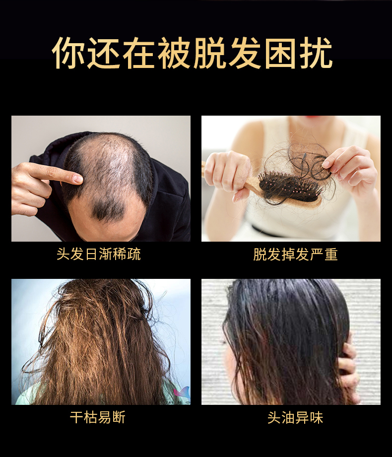 北京同仁堂 防脱育发洗发水 200ml瓶装 天猫优惠券折后￥19包邮（￥89-70）2款可选 京东￥68