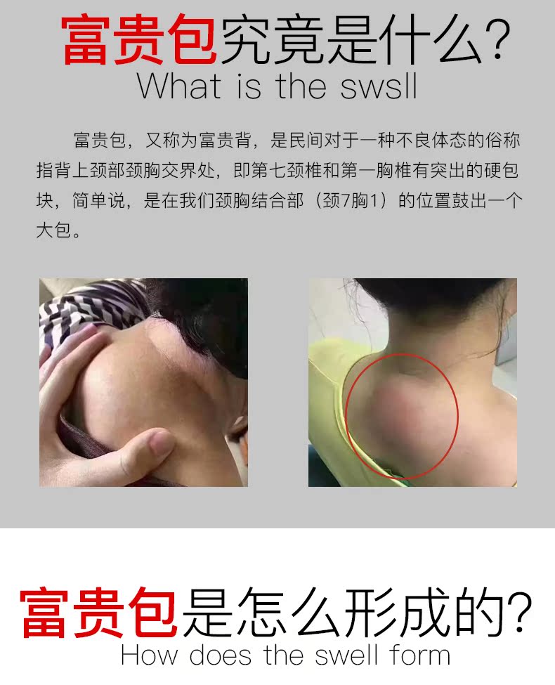 富贵包消除贴颈椎贴一盒5贴98元- 800折扣网