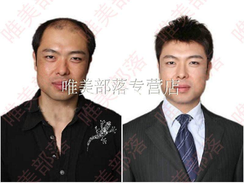 Extension mèches - Ref 225257 Image 39