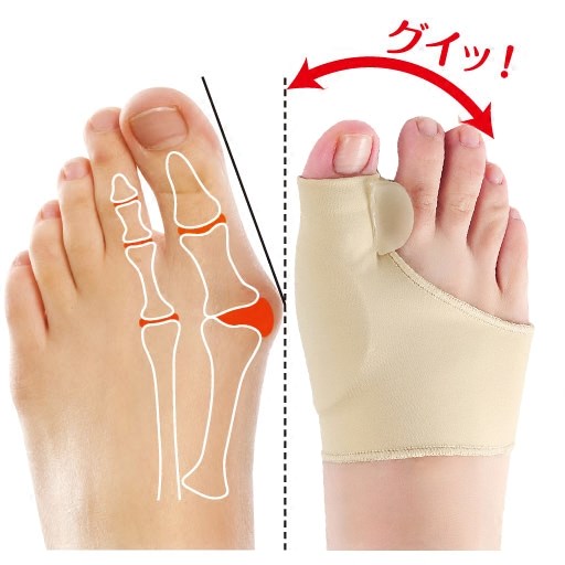 Foot Orthopedic Female Foot Orthotic Orthosis Lady Cuddler Feet Big Toe Thumb Valgus Straightener Can Be Worn