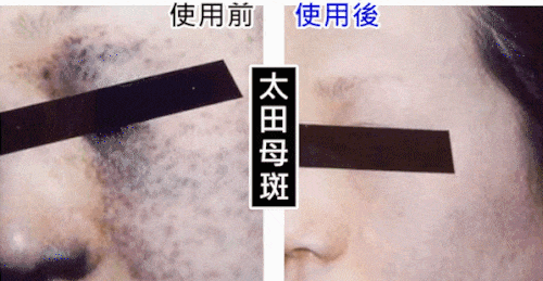 20231107_103608_060.gif