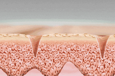11.gif