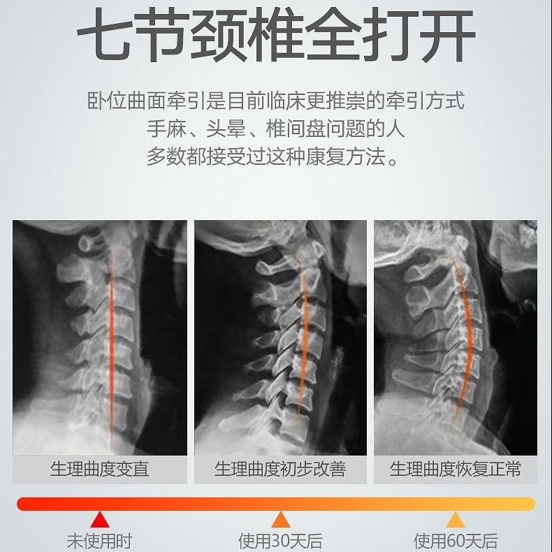 頸椎反弓枕頭睡覺專用修復矯正器人按摩牽引理療枕成人勁椎 頸椎反弓枕頭睡覺專用修復矯正器人按摩牽引理療枕成人勁椎