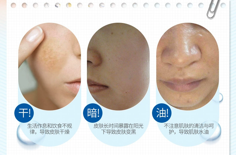 Glacier Moisturising Mask Moisturising Moisturising Moisturising Mặt nạ dưỡng ẩm - Mặt nạ