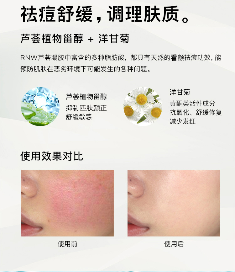 Hàn Quốc gel lô hội rnw chính hãng kem dưỡng ẩm trị mụn sau ánh nắng mặt trời gel kem mát và sảng khoái cho phái nữ