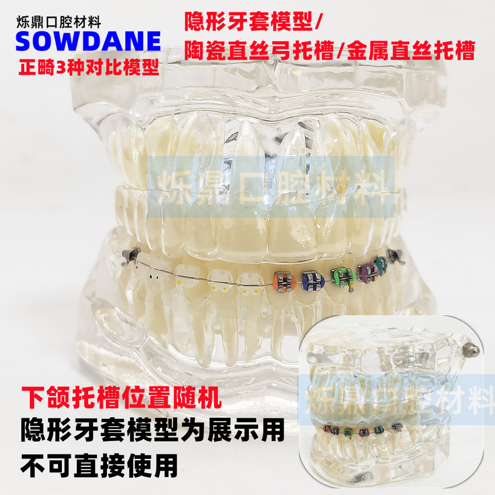 牙科牙模型隐形正畸模型医患沟通讲解教学模型正畸3种对比模型