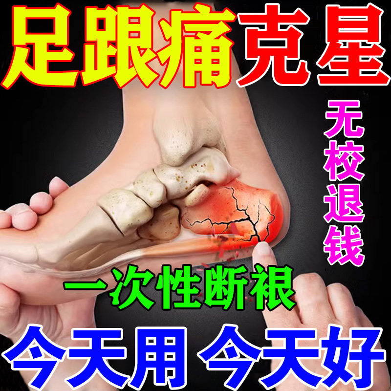 Crowdonic Zero Paste 2 for a hearty paste heel heel Bone Spurs Official Foot Liv and Pain Cream-Taobao