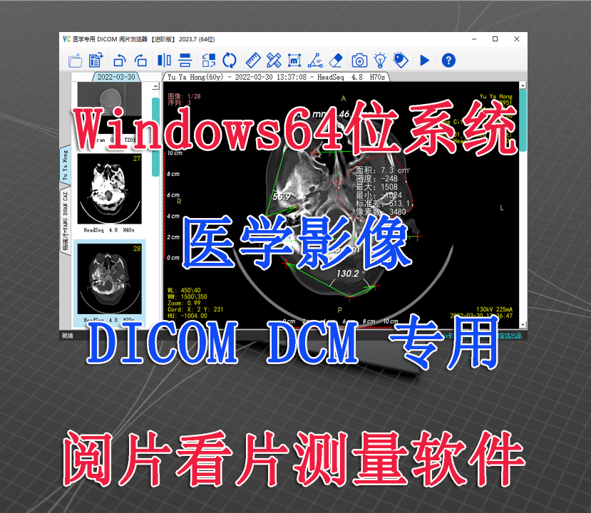 Microsoft Win64-Bit System Medical Imaging Dicom Dcm File Viewing and Measurement Software Microsoft Win64-Bit System Medical Imaging Dicom Dcm File Viewing and Measurement Software