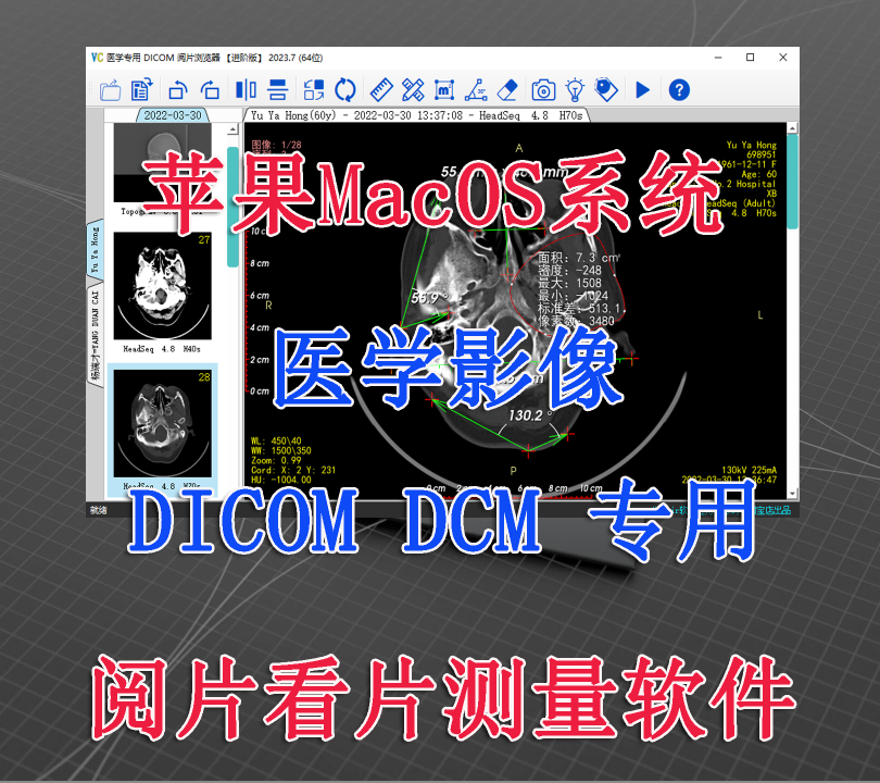 Apple Macos System Medical Imaging Dicom Dcm File Viewing, Viewing, Playback, Measurement, and Viewing Software Apple Macos System Medical Imaging Dicom Dcm File Viewing, Viewing, Playback, Measurement, and Viewing Software