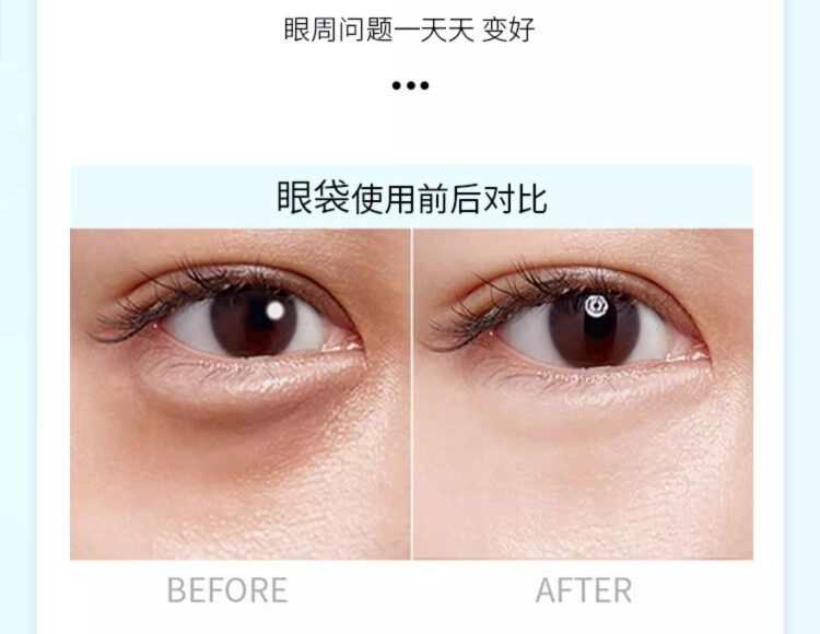 Microcrystalline Eye Mask Hydrogel Technology - Detail image 2