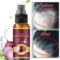 Hair Growth Serum Spray Repair Hair Strong Nourish Hair Root