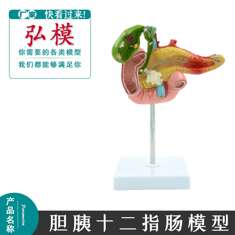 胰腺十二指肠胆囊病理模型胆结石外科消化系统模型人体结构模玩具