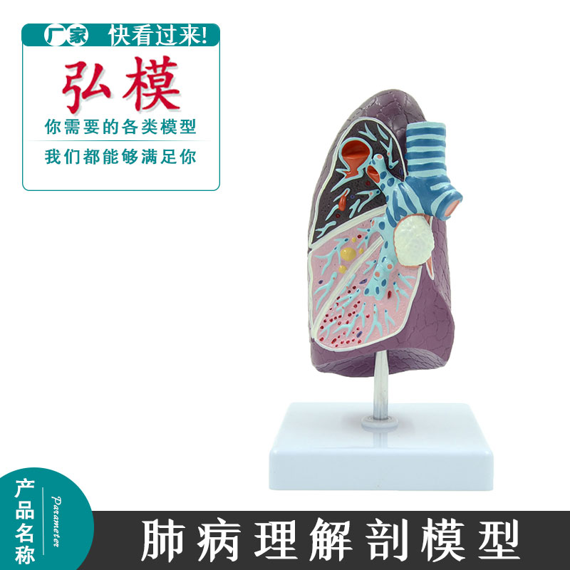 人体肺模型吸烟者肺结核肺炎模具胸外科呼吸科肺病理解剖结构模拟