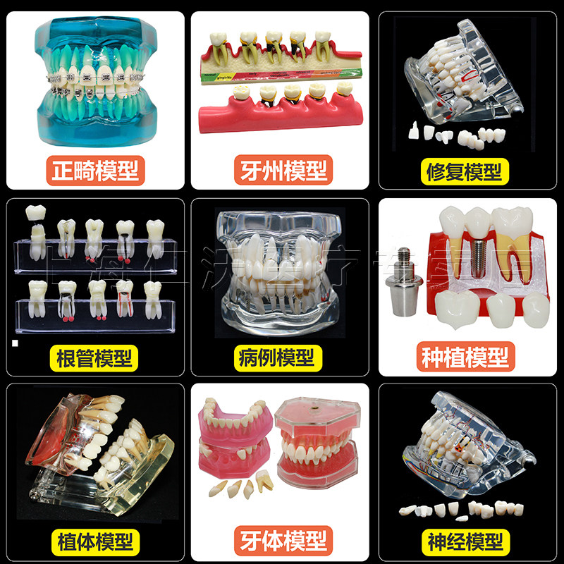 Dental model Oral teaching model Dental model Orthodontic mold Dental model implant model Restoration model