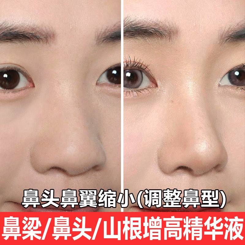 Nose Change Quite God Instrumental High Nose Beam Heightening Fine China Liquid Collapse Savior Nose Wing Nose Shrink Slim Nose Meme Essential Oils-Taobao