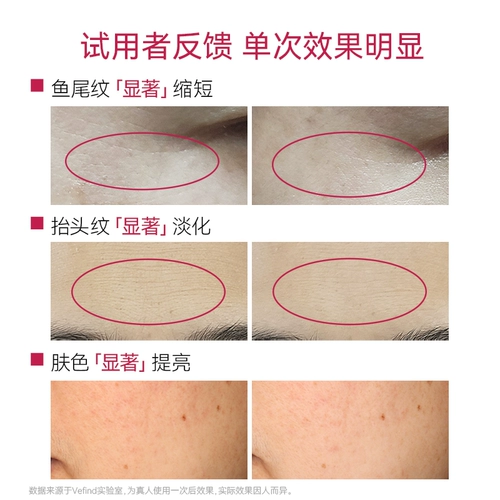 VeFind/微梵 Одиночный RF Beauty Instrump