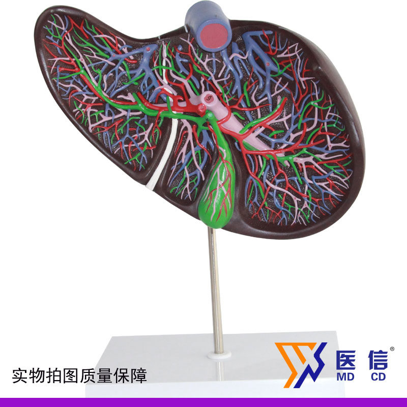 医用 肝胆囊放大模型 肝脏解剖肝脏动静脉结构胆囊消化科模型
