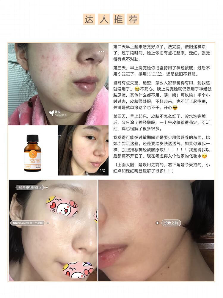 Tinh chất Nhật Bản ceramide nguyên chất huyết thanh nữ dưỡng ẩm làm dịu sửa chữa cơ nhạy cảm serum vàng