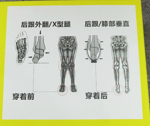 Детские корректирующие демисезонные высокие сапоги подходит для мужчин и женщин
