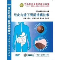 Percutaneous Endoscopic Gastroenterostomy DVD Complete Collection of Digestive Endoscopy Techniques Edited by Professor Wang Zhiqiang