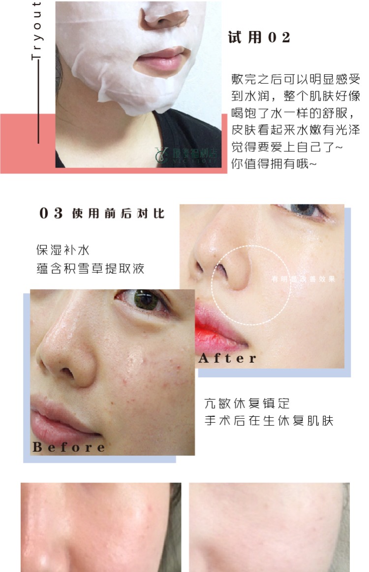 Dongguo Dược phẩm Centellian24 Sentley Centella asiatica sửa chữa mặt nạ để cứu vấn đề cơ bắp 10 viên mặt nạ innisfree trà xanh