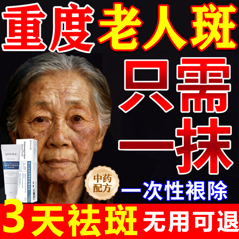 Powerful Removal of Age Spots, Removal of Chloasma and Freckles on Hands and Face, Special Anti-Spot Cream for the Elderly, Official Authentic Product