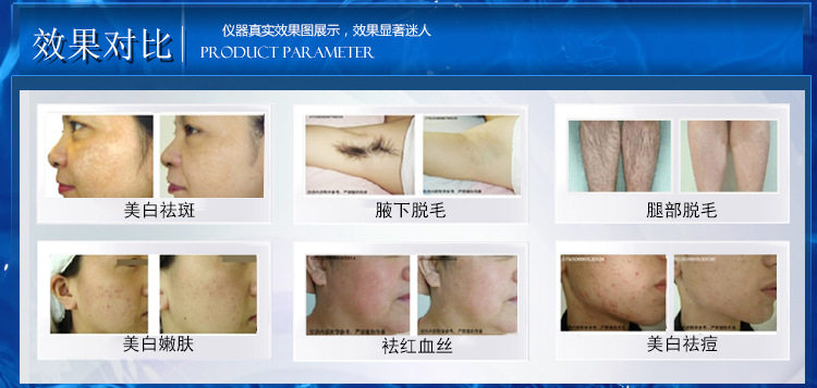 点击打开原图 OPT脱毛仪冰点无痛激光洗眉洗纹身多功能美容仪器