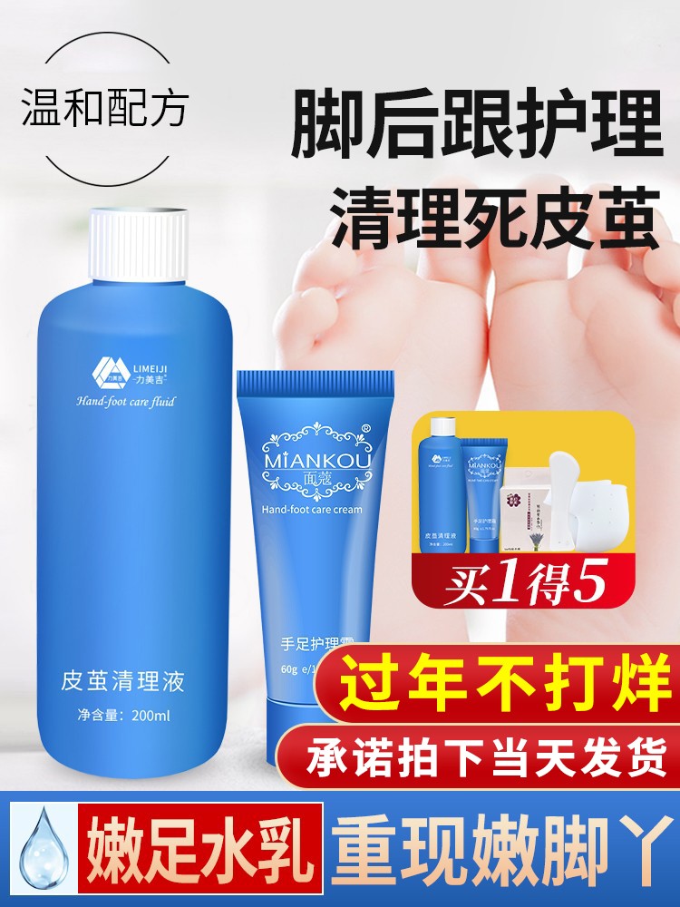 Heel calluses, soles, horny feet, pedicures, foot scrapers, tender feet, home grinding feet artifacts, non-exfoliating dead skin