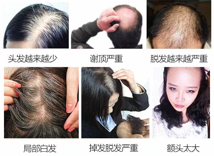 Extension mèches - Ref 219821 Image 19