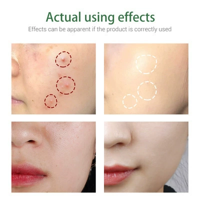 Очищающее молочко, крем для лица, анти-акне, 100г