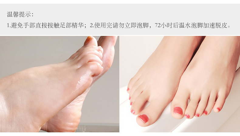 Cánh đồng hoa mẫu đơn nửa cánh đồng trắng muốt cho da chết Ông lão chống khô làm trắng dưỡng ẩm chăm sóc chân lột chân màng phim tẩy da chai cứng ở gót chân