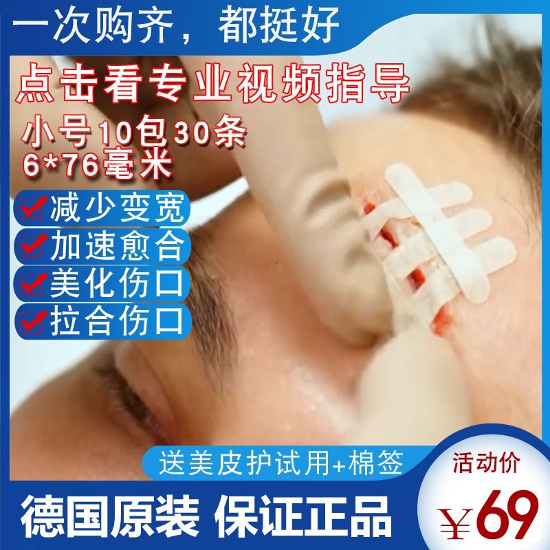 German free-sewn surgical adhesive tapes Omnistrip anti-change Posting Scarring Child Anti-Change Wide Sticker-Taobao