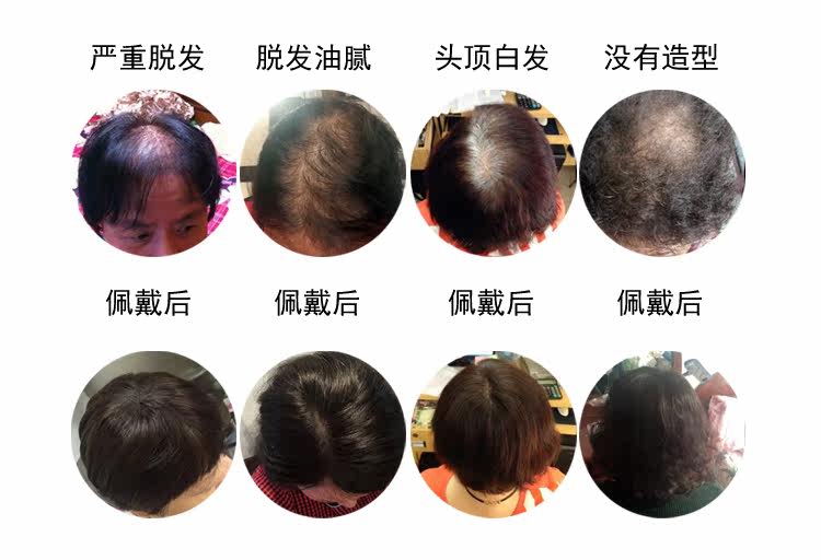 Extension cheveux - Ref 225896 Image 8