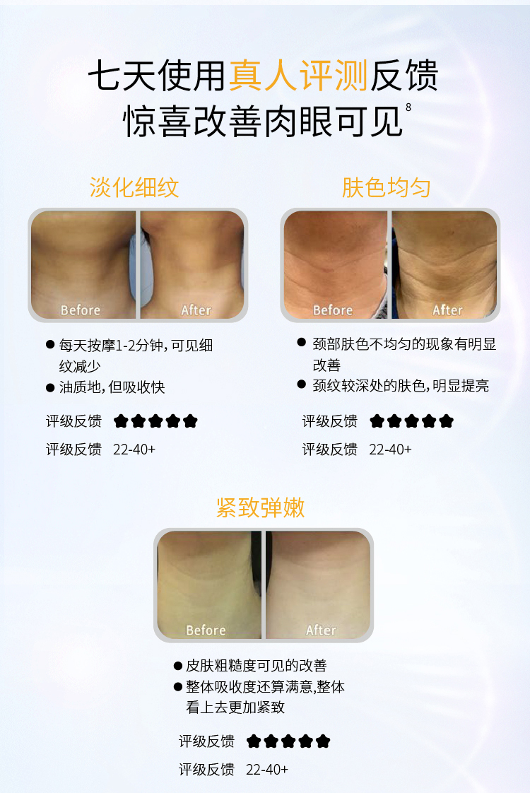 Han Chenghao Fengti Tightening Repair Chống nhăn Dưỡng ẩm cho Cổ Thiên nga Tinh chất làm giảm nếp nhăn 30 Viên nang tinh chất