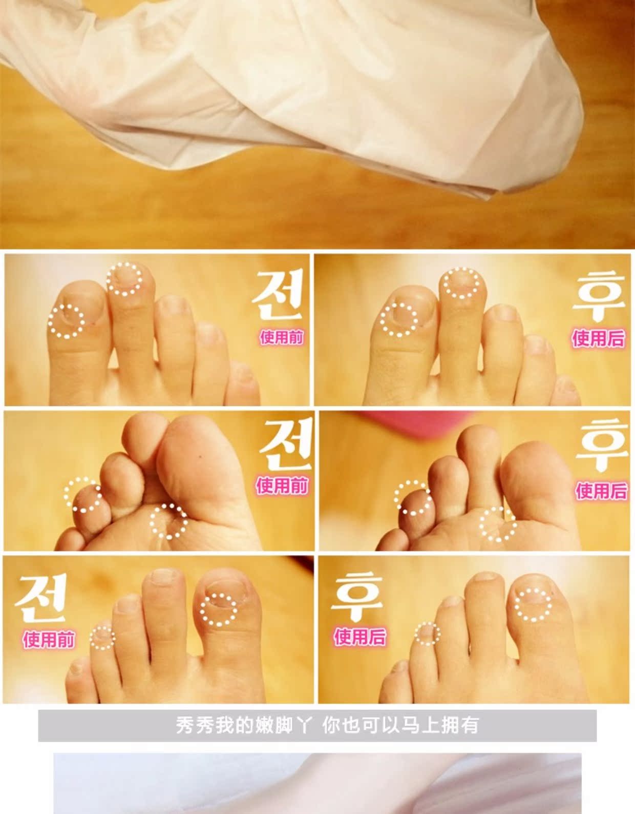 Hàn Quốc Chính hãng Clinie Kelaisi Foot Mask dịu dàng tẩy tế bào chết da chết Bộ phim chăm sóc chân cũ 5 lắp ráp mặt nạ tay chân