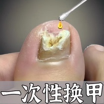 Tongrentang hot sale (grow new nails in seven days). One drop of it can turn bad nails into good ones and grow new nails. It can inhibit bacteria without removing nails.