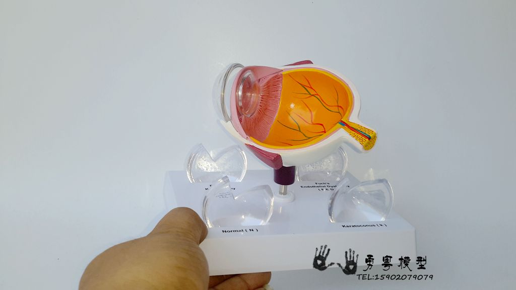 眼球疾病 眼睛解剖 眼球构造 角膜疾病 眼球模型 眼睛模型