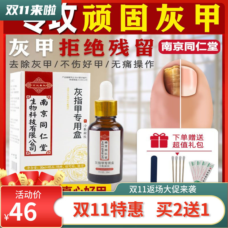 Nanjing Tongrentang Yan'er 1 Kang onychomycosis bright 1 nail fungus special medicine onychomycosis special medicine onychomycosis