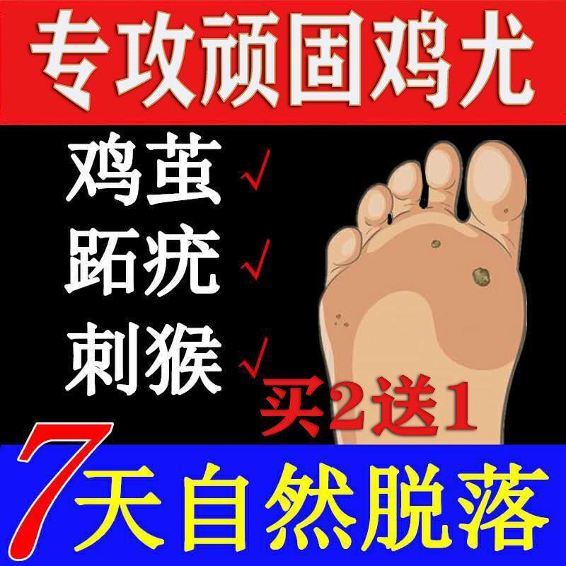 Chicken eye paste chicken eye paste chicken eye paste chicken eye paste, toe tattoo monkey to wart 1 spirit