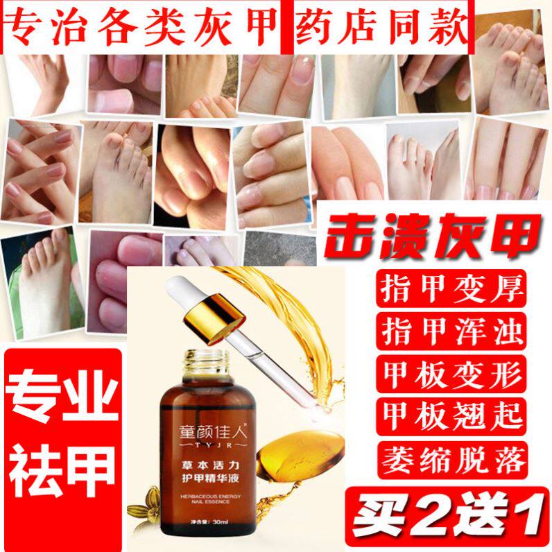 Japan small forest feet gas grey nail water grey nail treatment special medicine foot toenalam herbbacteriostatic liquid grainy nail
