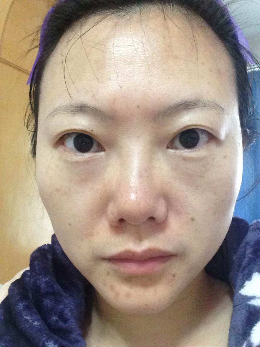 新七白嫩肤面膜