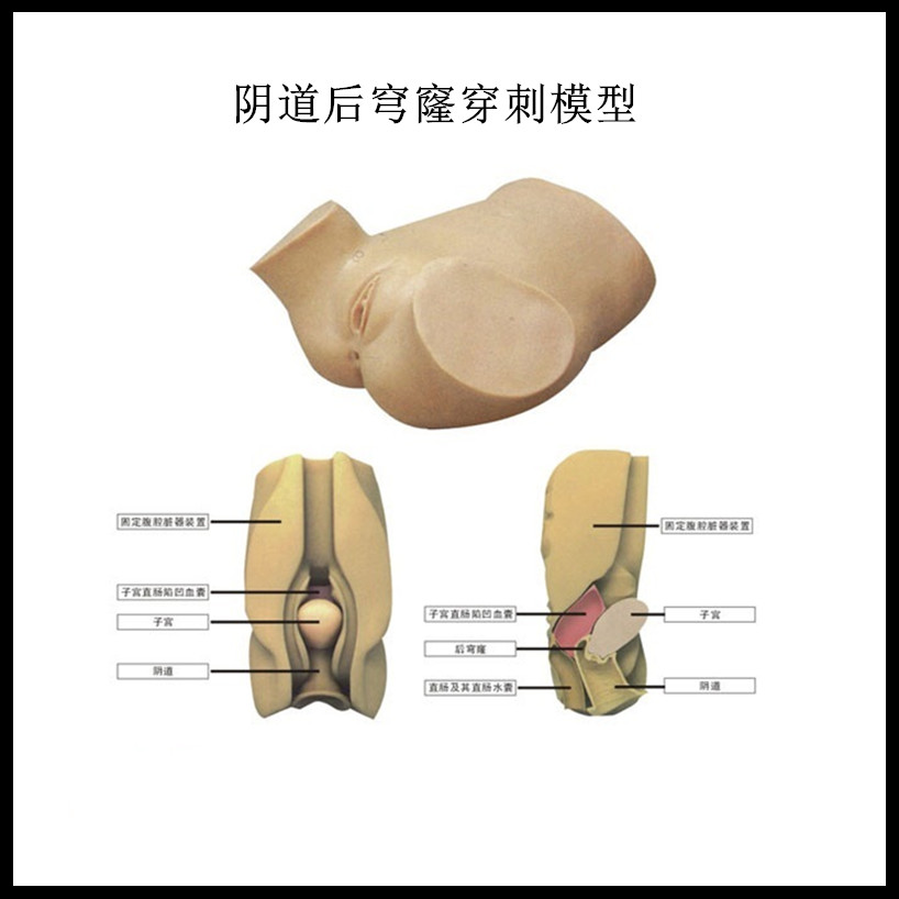 厂家直销阴道后穹窿穿刺模型 妇科培训医学模型