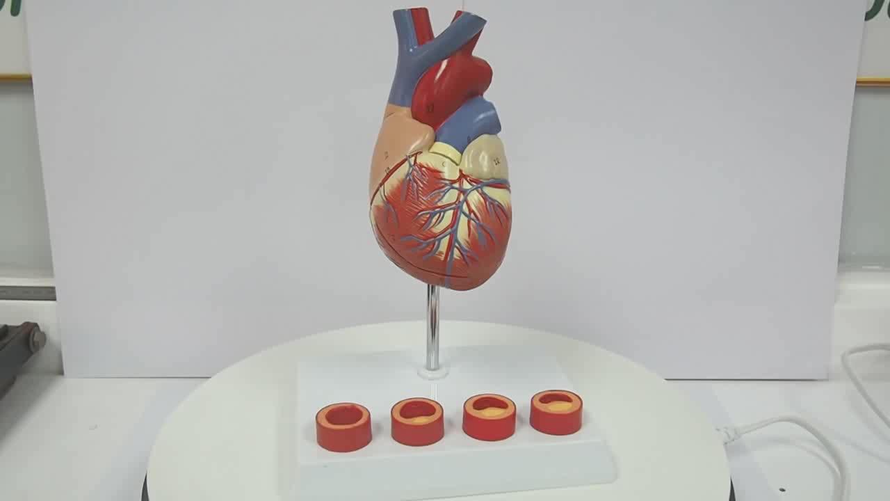 Atherosclerosis Plastic Human Heart Model For Medical Teaching, View